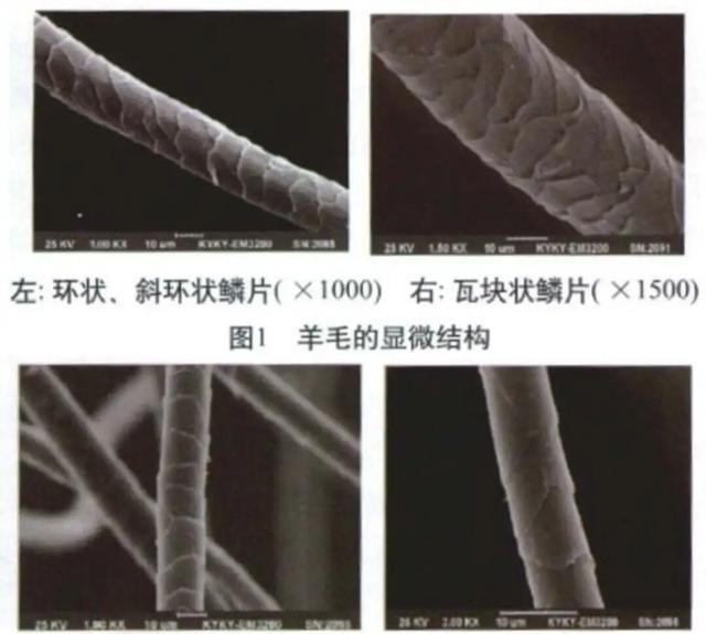 穿不了高領(lǐng),原來是一種病?